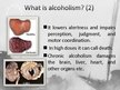 Prezentācija 'Alkoholisms un rehabilitācija', 4.
