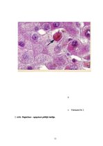 Referāts 'Apoptoze', 11.