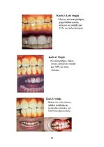 Referāts 'Fluorīdu ietekme uz mutes dobuma veselību', 17.