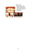 Referāts 'Fluorīdu ietekme uz mutes dobuma veselību', 18.