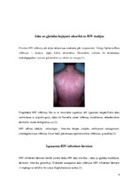 Referāts 'HIV ādas izpausmes', 4.