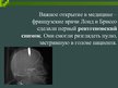 Prezentācija 'Технические открытия конца 19 начало 20 веков', 4.