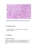 Eseja 'Neirofibromatoze', 7.