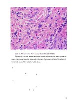 Referāts 'Perianālā/anāla furunkuloze suņiem', 14.