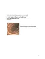 Konspekts 'Celiakija', 7.