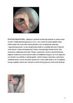 Referāts 'Balss traucējumi', 8.