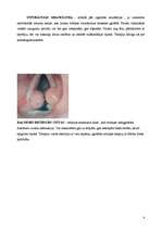 Referāts 'Balss traucējumi', 9.