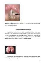 Referāts 'Balss traucējumi', 10.