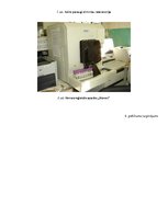 Referāts 'Asins analīžu izmaiņas no cērmju invāzijas, kuņģa - zarnu trakta asiņošanas un c', 29.