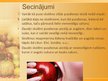 Referāts 'Skolēnu ēšanas paradumi', 39.