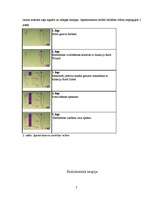 Referāts 'Endodontijas ierīces', 7.