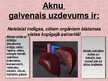 Prezentācija 'Aknu ciroze', 3.