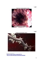 Referāts 'Kuņģa-zarnu trakta kandidoze', 12.