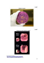 Referāts 'Kuņģa-zarnu trakta kandidoze', 13.