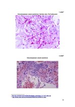 Referāts 'Kuņģa-zarnu trakta kandidoze', 14.