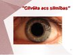 Prezentācija 'Cilvēka acu un redzes slimības', 1.
