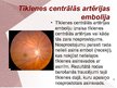 Prezentācija 'Cilvēka acu un redzes slimības', 8.