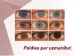Prezentācija 'Cilvēka acu un redzes slimības', 19.