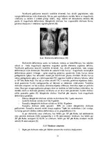 Referāts 'Sakarības starp stājas traucējumiem un elpošanas sistēmas  darbību', 11.