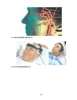 Referāts 'Datora ietekme uz cilvēka veselību, kas saistīta ar mugurkaula centrālās asinsri', 44.