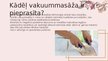 Prezentācija 'Vakuummasāža', 10.