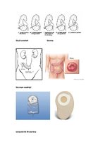 Konspekts 'Urostomas', 13.
