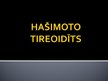 Prezentācija 'Hašimoto tireoidīts', 1.