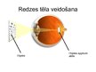 Prezentācija 'Cilvēka redze', 6.