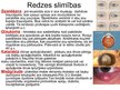Prezentācija 'Cilvēka redze', 10.