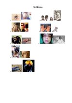 Konspekts 'Nervu sistēmas slimības', 2.