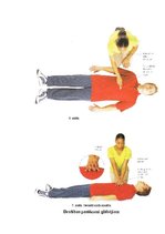 Konspekts 'Pieauguša cilvēka ABC algoritms, bez agrīnas defibrilācijas', 13.