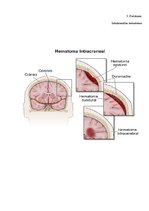 Referāts 'Aprūpes prioritātes pēc traumatiska asins izplūduma galvas smadzenēs', 37.