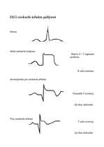 Konspekts 'Miokarda infarkts', 4.