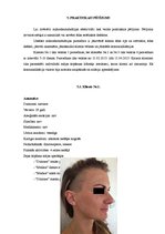 Referāts 'Ādas estētisko problēmu risinājumi ar mikrodermabrāziju', 16.