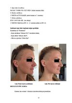 Referāts 'Ādas estētisko problēmu risinājumi ar mikrodermabrāziju', 18.