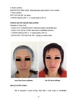 Referāts 'Ādas estētisko problēmu risinājumi ar mikrodermabrāziju', 21.