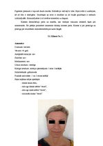 Referāts 'Ādas estētisko problēmu risinājumi ar mikrodermabrāziju', 22.