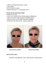 Referāts 'Ādas estētisko problēmu risinājumi ar mikrodermabrāziju', 24.