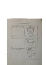 Referāts 'Ādas estētisko problēmu risinājumi ar mikrodermabrāziju', 28.