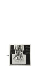 Referāts 'Ādas estētisko problēmu risinājumi ar mikrodermabrāziju', 29.