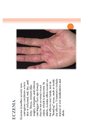 Prezentācija 'Skin Disease', 4.