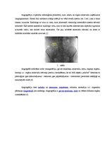 Konspekts 'Angiogrāfija', 4.