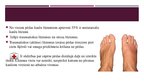 Prezentācija 'Metatarsālo kaulu lūzumi', 3.