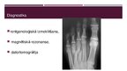 Prezentācija 'Metatarsālo kaulu lūzumi', 4.