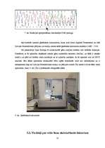 Referāts 'Vēža šūnu aktivizēšanās faktori un vēža diagnosticēšanas iespējas mūsdienu tradi', 33.