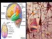 Prezentācija 'Cilvēka nervu sistēma un tās slimības', 26.
