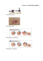 Referāts 'Vecāku rīcība pie ērces piesūkšanās bērniem', 40.