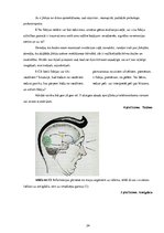 Referāts 'Fobijas, to ietekme uz cilvēka fizisko un garīgo veselību un prezentācija', 34.