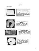 Referāts 'Biežākie miega traucējumi no studentu viedokļa', 22.