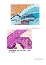 Referāts 'Acs priekšējā kakta uzbūve un fizioloģija', 12.